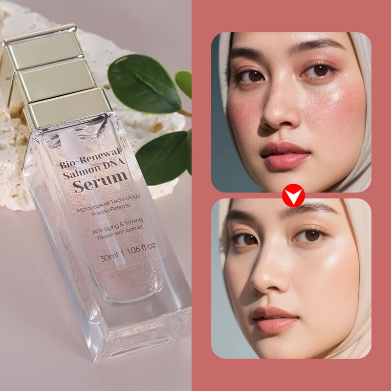 Anti Aging Skin Care Face Ordinary Niacinamide Serum Portulaca Salmon Dna Pdrn Korean Serum for Face thumbnail 12