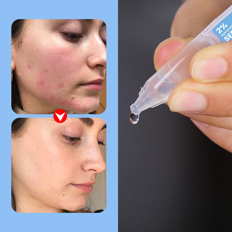 Beauty Anti Wrinkle Ordinary Niacinamide Serum Natural Hyaluronic Acid Vitamin C Anti-aging Instant Face Lift Korean Serum thumbnail 12