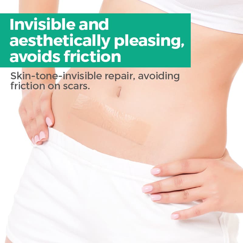 Collagen Silicone Scar Tape Gel Removal Patches Scar Tape Roll for Surgical Scars thumbnail 10