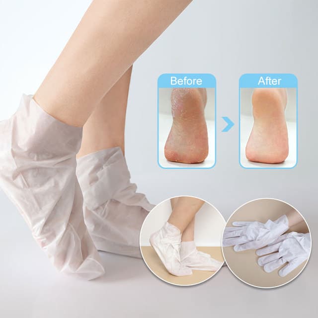 Foot Peel Manufacturing: From 20% Lactic Acid to Medical-Grade Diabetic Foot Care