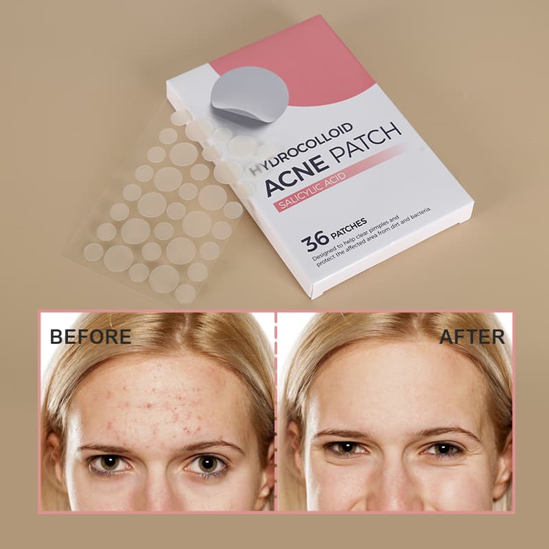Hydrocolloid Salicylic Acid Acne Pimple Patch Facial Acne Products Dots for Spots Acne Patches - image 1