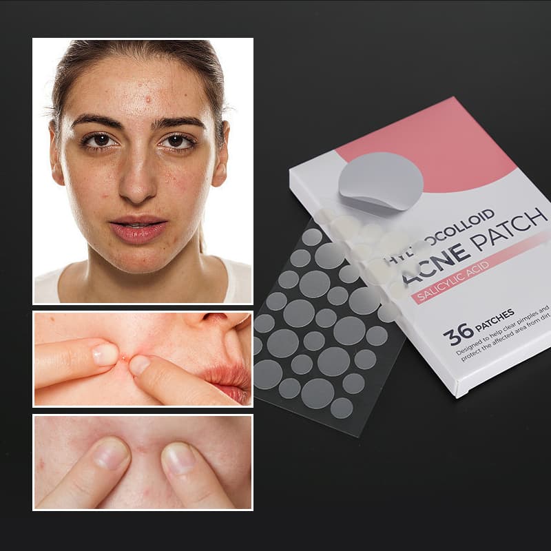 Hydrocolloid Salicylic Acid Acne Pimple Patch Facial Acne Products Dots for Spots Acne Patches thumbnail 4