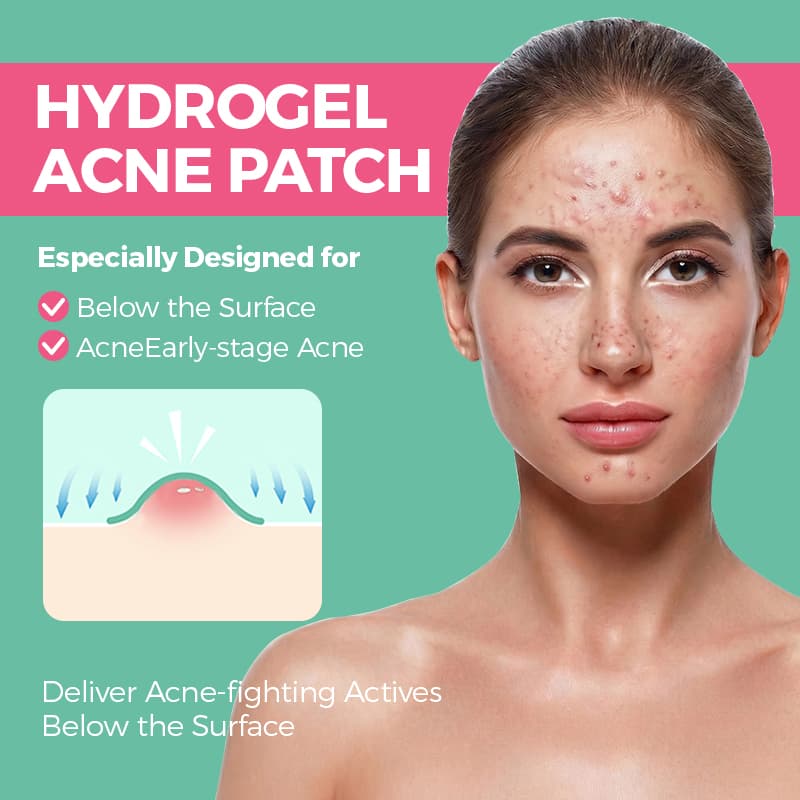 Logo Korean Salicylic Acid Hydrocolloid Acne Pimple Patch Stickers Pimple Patches for Face thumbnail 5