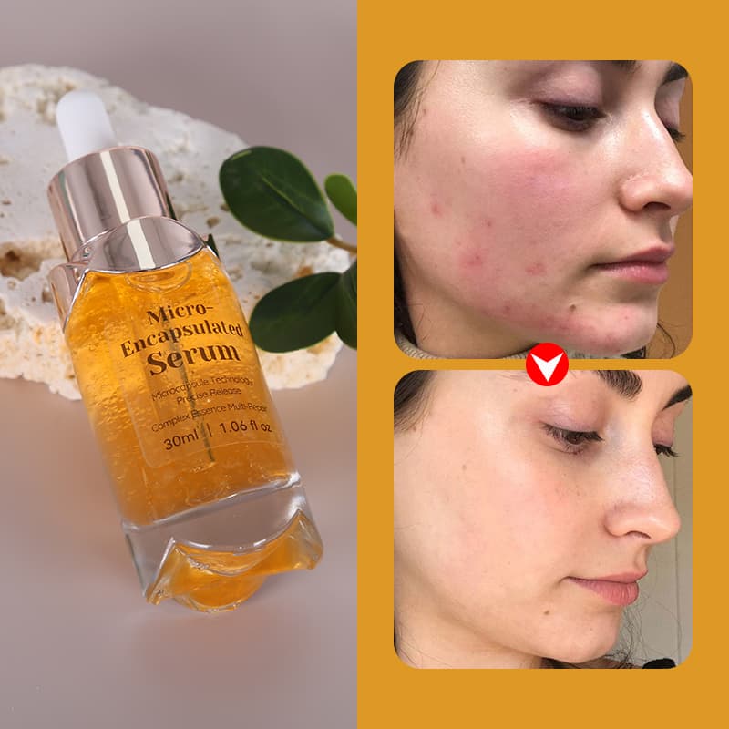 Moisturize Korean Skin Care Serum Soluble Collagen Glycol Anti Aging Salmon Dna Vitamin C Instant Face Lift Serum thumbnail 12
