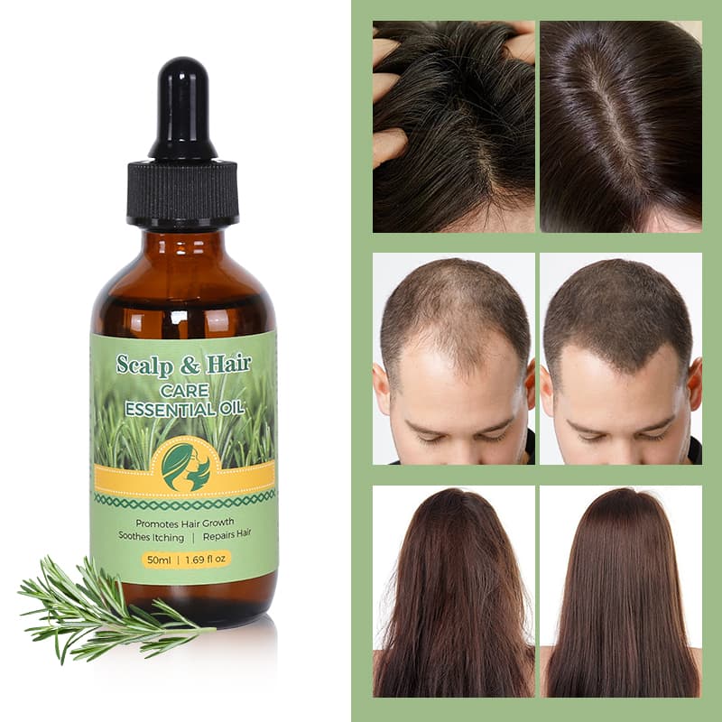 Natural Long Hair Oil Men Women Best Rosemary  Hair Growth Oil Products thumbnail 8
