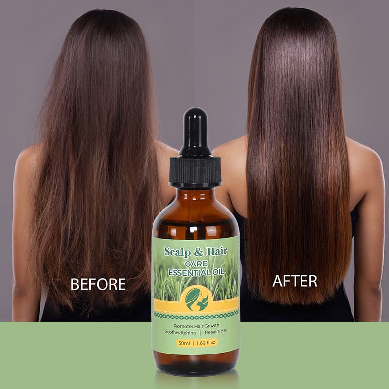 Natural Long Hair Oil Men Women Best Rosemary  Hair Growth Oil Products thumbnail 10