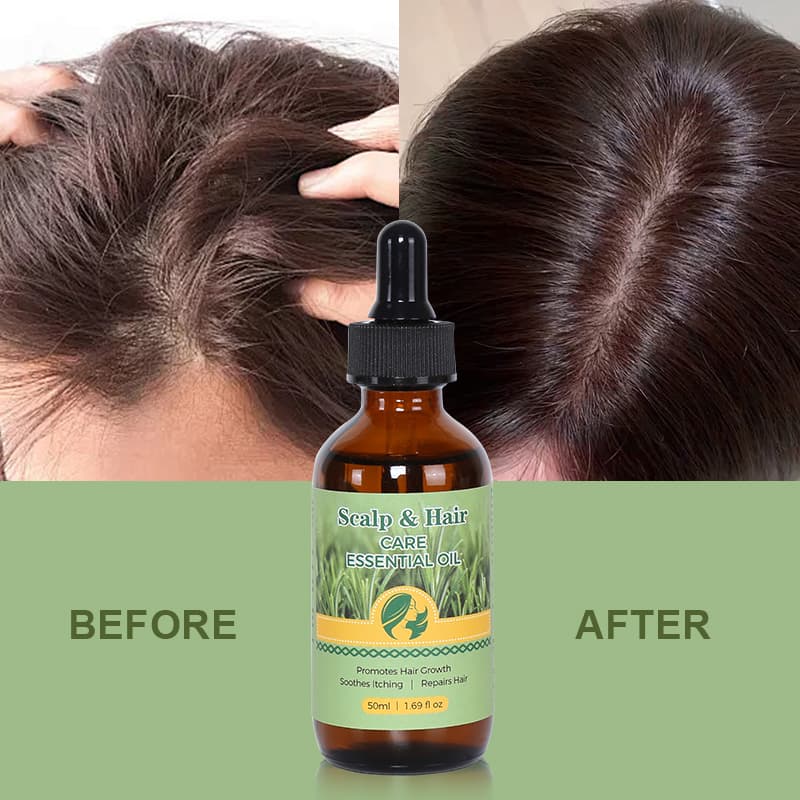 Natural Long Hair Oil Men Women Best Rosemary  Hair Growth Oil Products thumbnail 11