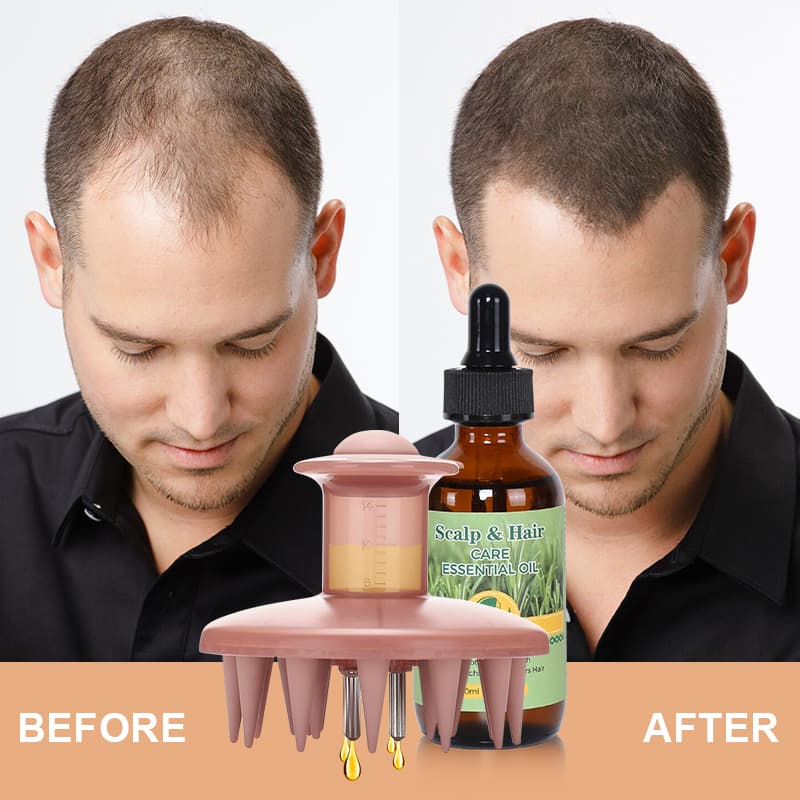 Organic Vegan Peptides Moisturizing Hair Growth Serum for Hair Regrowth & Scalp Massage thumbnail 18