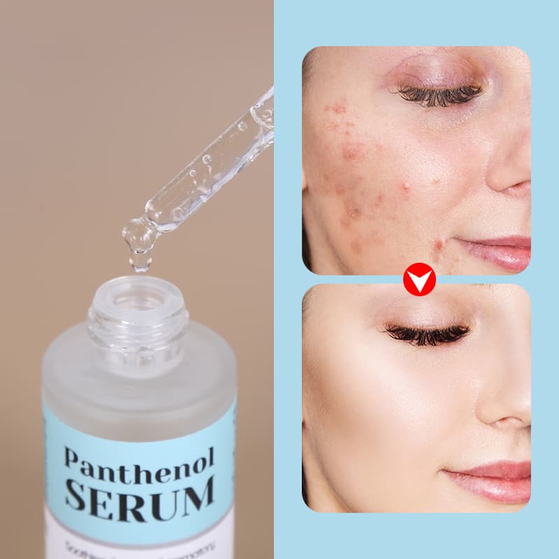 Skincare Ordinary Niacinamide Serum Moisturizing Brightenin Collagen Vitamin C Serum f thumbnail 13