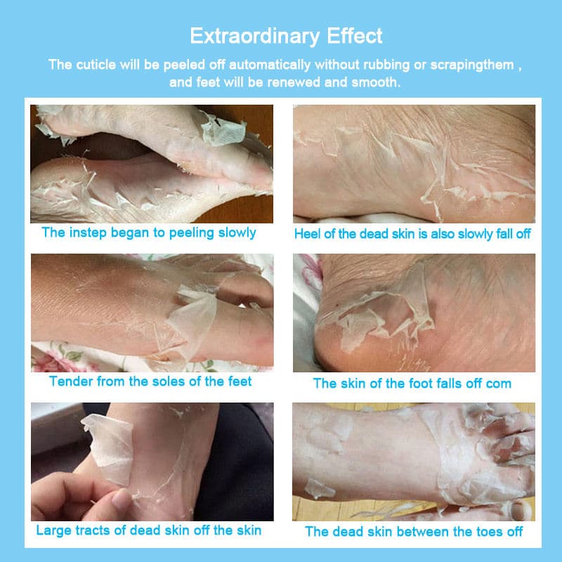 Foot & Heel Care detail 10