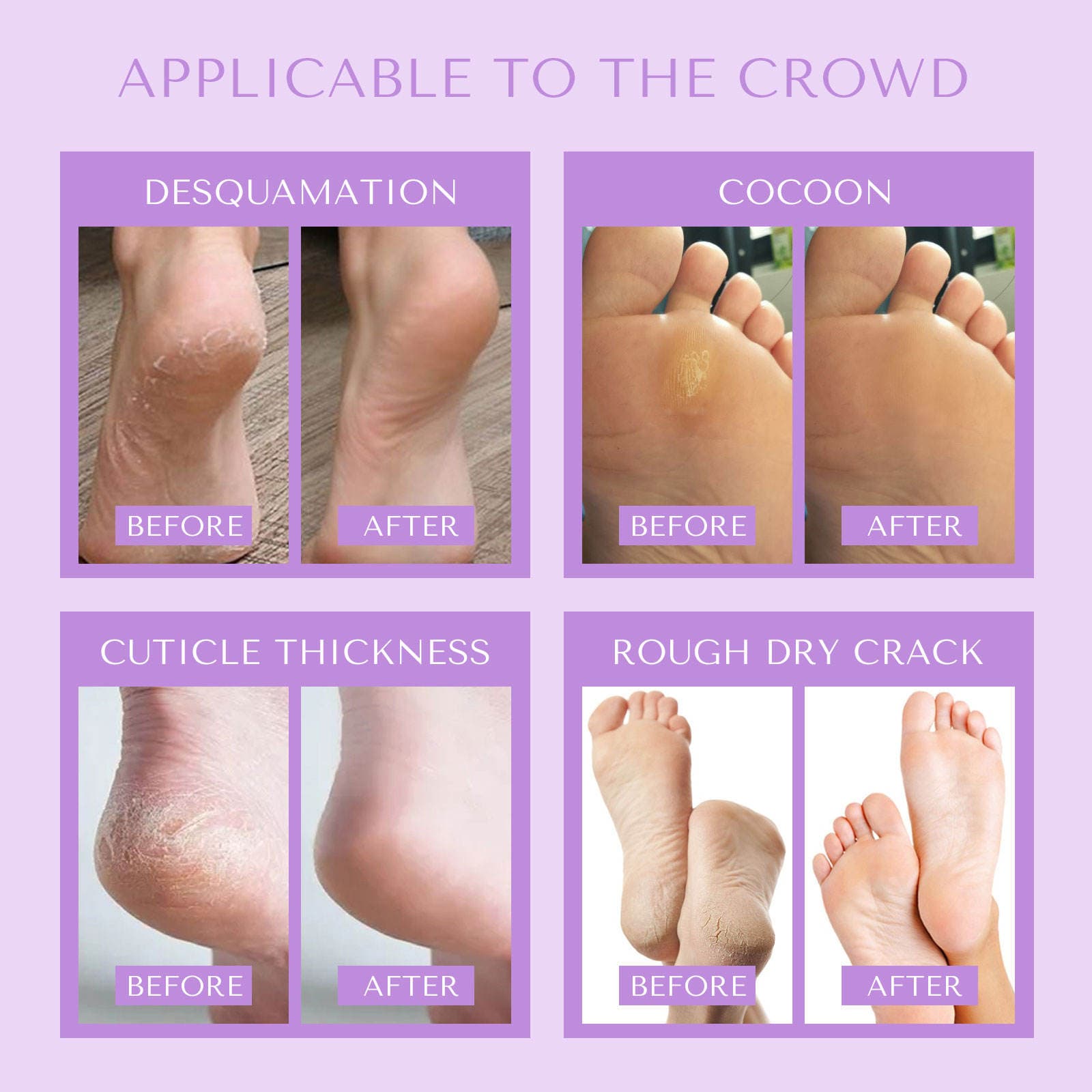 Foot & Heel Care detail 14
