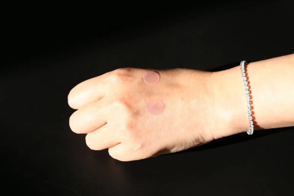 UV-Sensitive Acne Patch - 23
