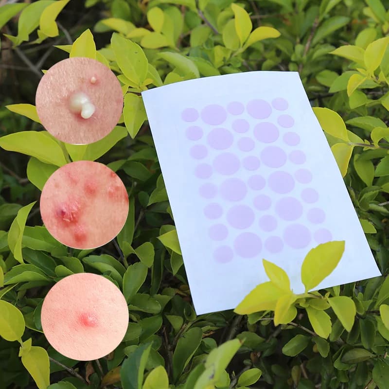 UV-Sensitive Acne Patch - 2