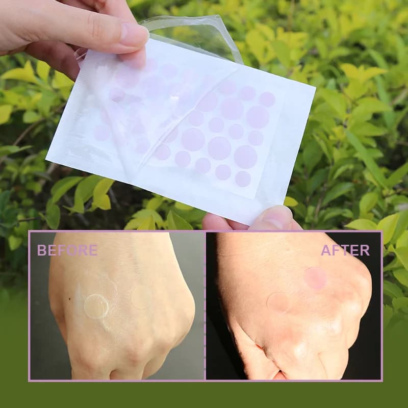 UV-Sensitive Acne Patch - 6