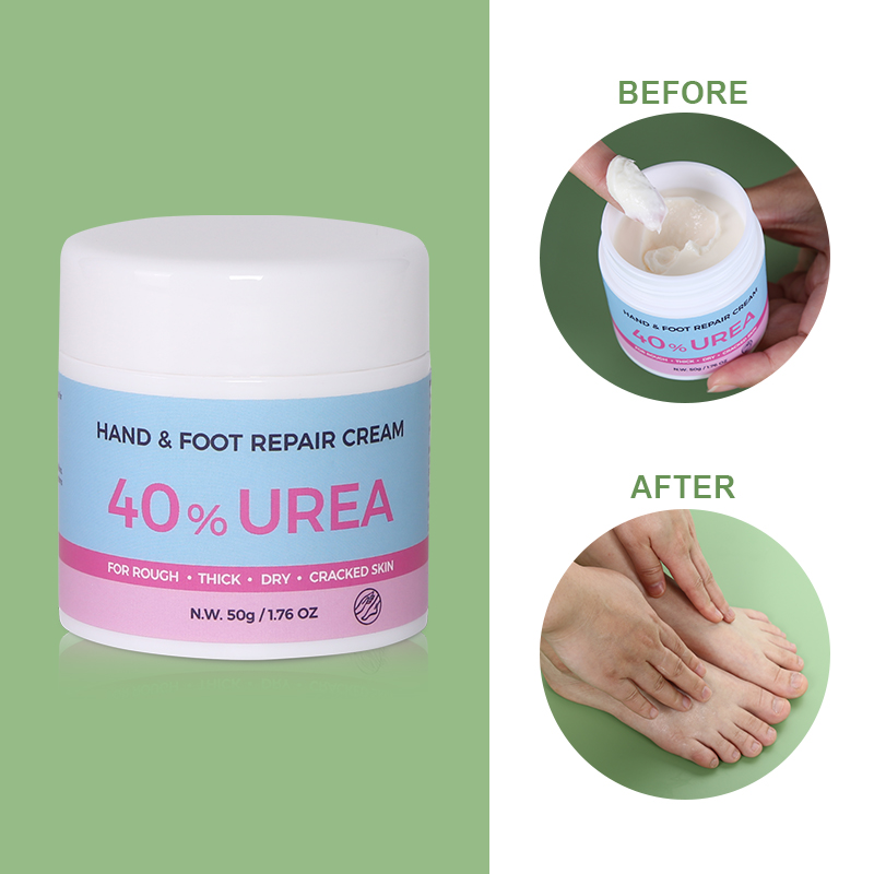 Allantoin Hand & Foot Cream - 4