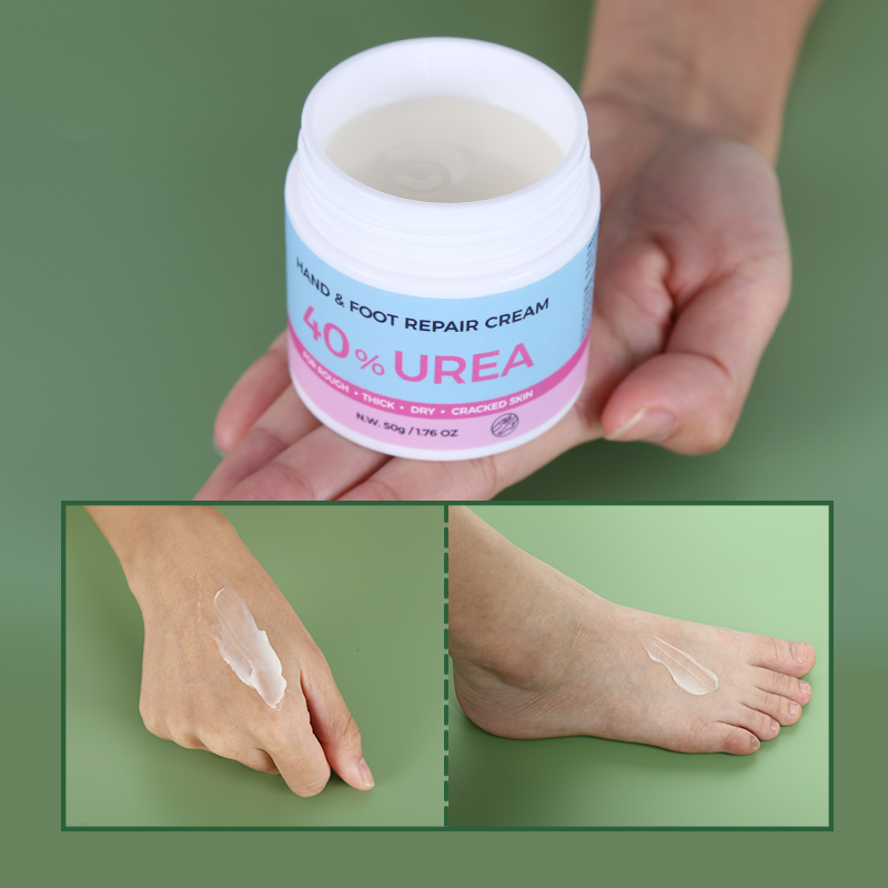Allantoin Hand & Foot Cream - 5