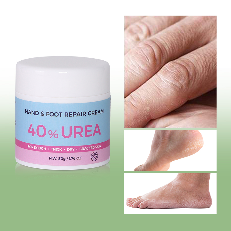 Allantoin Hand & Foot Cream - 6
