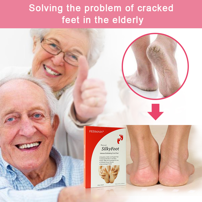 Callus Removal Foot Mask (Red Box) - 10
