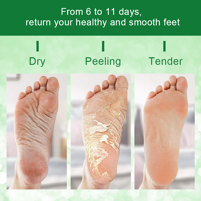 Callus Removal Foot Mask (Custom) - 3