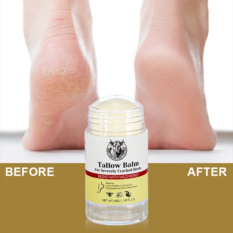 Foot & Heel Care thumbnail 56
