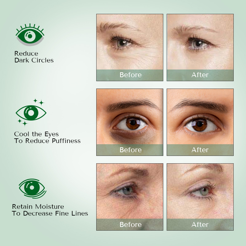 Gel Eye Mask Mix - 7