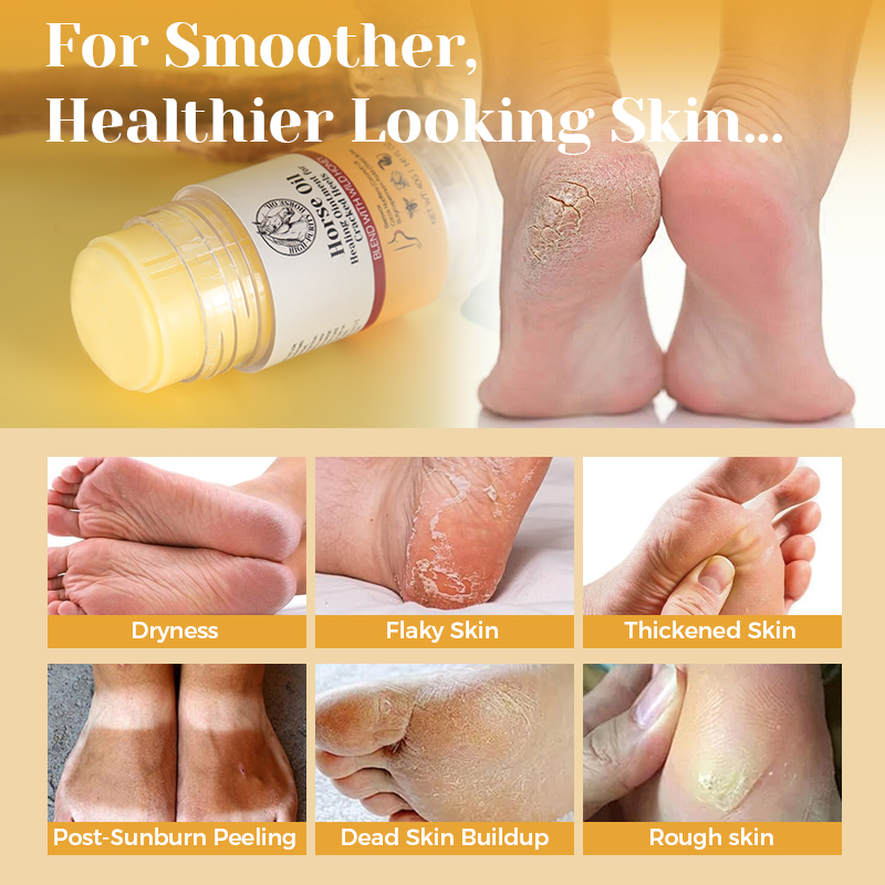 Horse Oil Heel Crack Cream - 2
