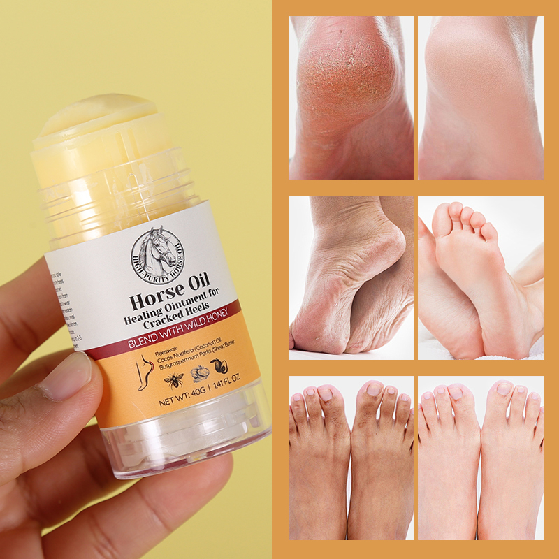 Horse Oil Heel Crack Cream - 9