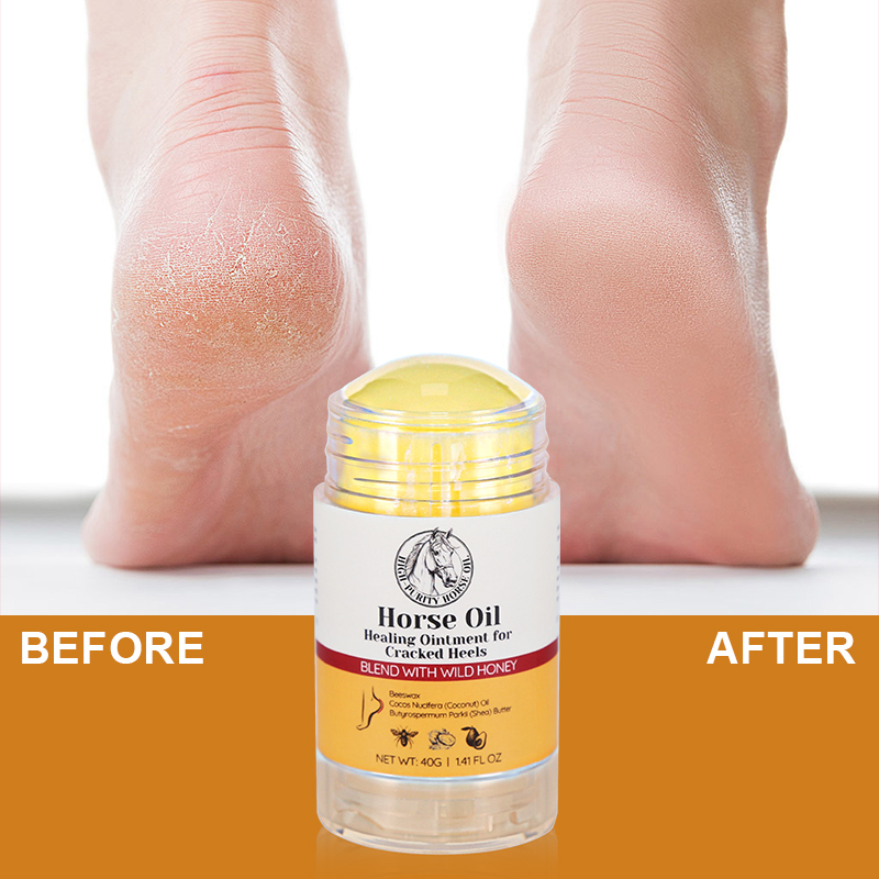 Horse Oil Heel Crack Cream - 10