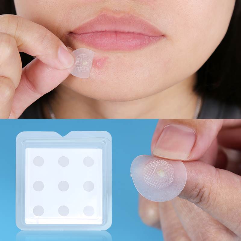 Microneedle Acne Patch (4+9 Pack) - 6