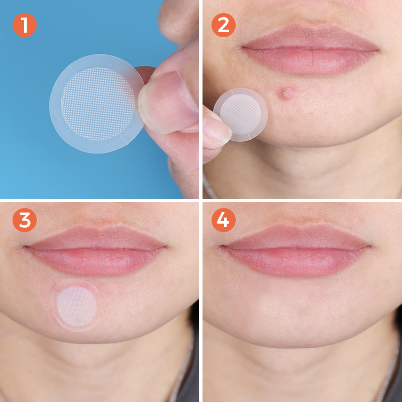 Microneedle Acne Patch (4+9 Pack) - 12