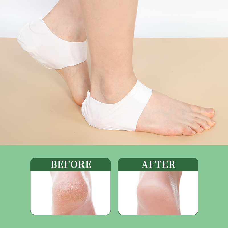 Moisturizing Heel Mask - 4