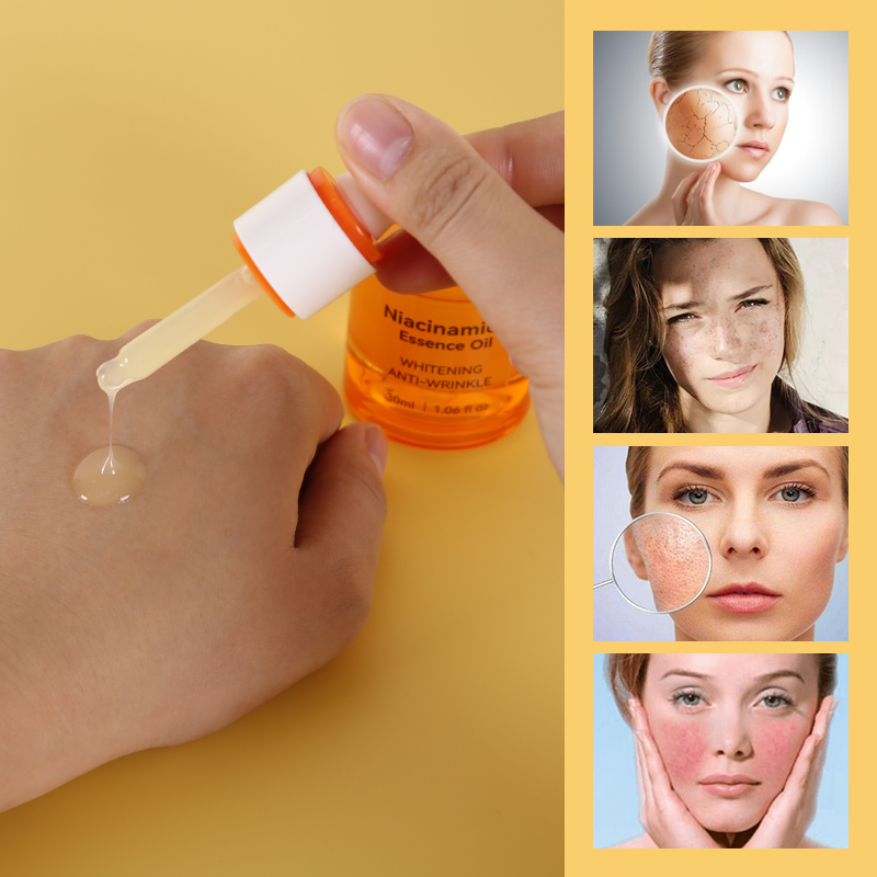 Niacinamide Oil (Orange) - 7