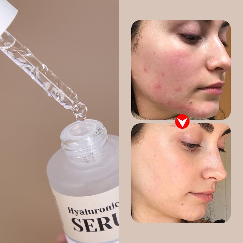 Panthenol Ordinary Niacinamide Instant Face Lift Serum Hydrolyzed Sodium Hyaluronate Skincare Moisturizing Centella Repair Serum thumbnail 14