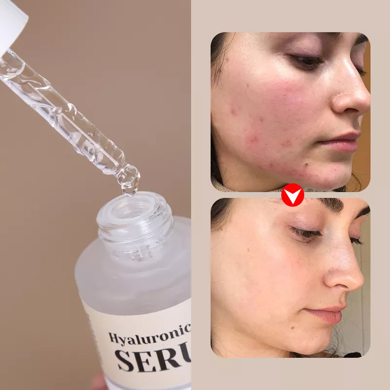 Serum Muka Mengangkat Niasinamid Panthenol - 14