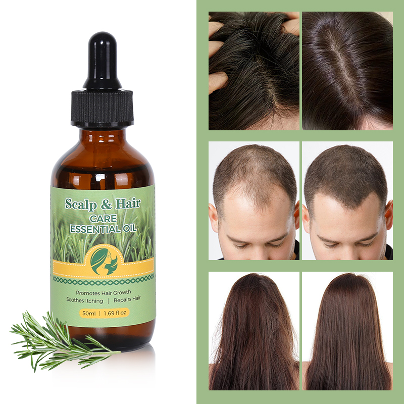 Scalp & Hair Treatment Oil - 8