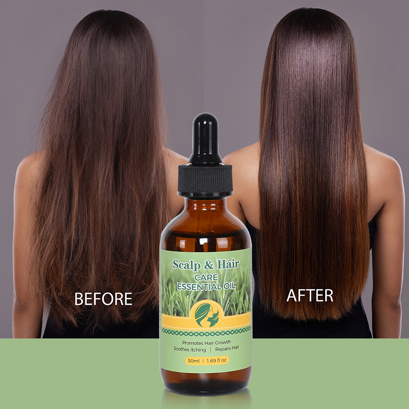 Scalp & Hair Treatment Oil - 10
