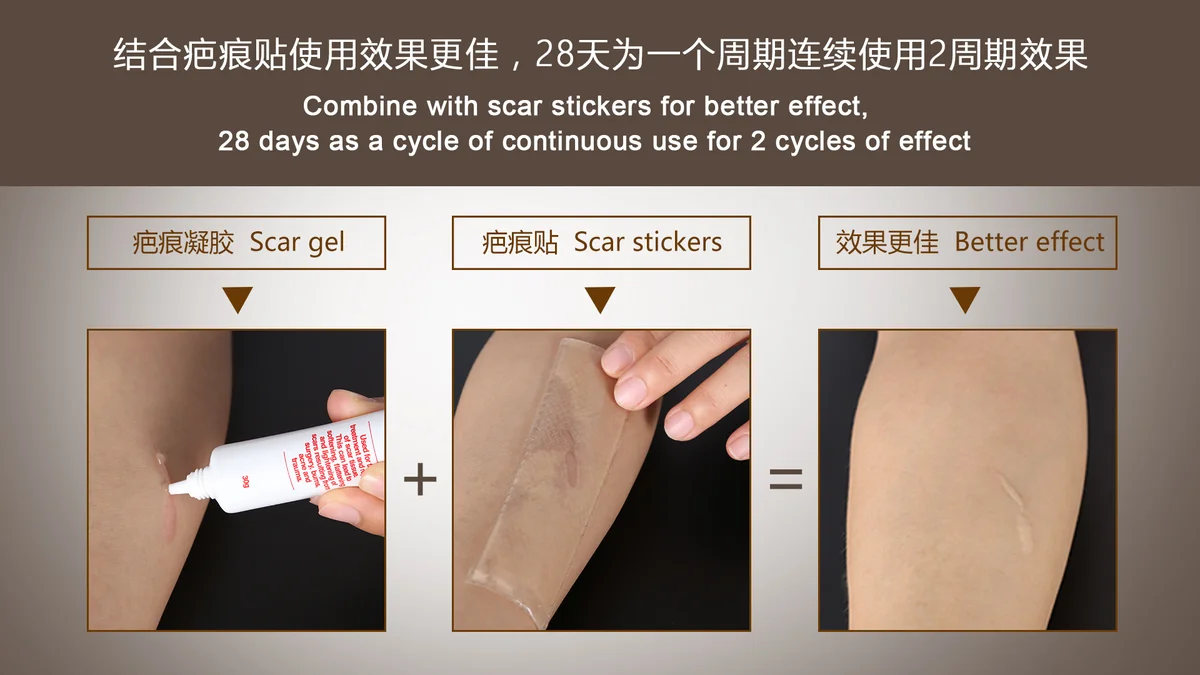 Scar Gel - 7