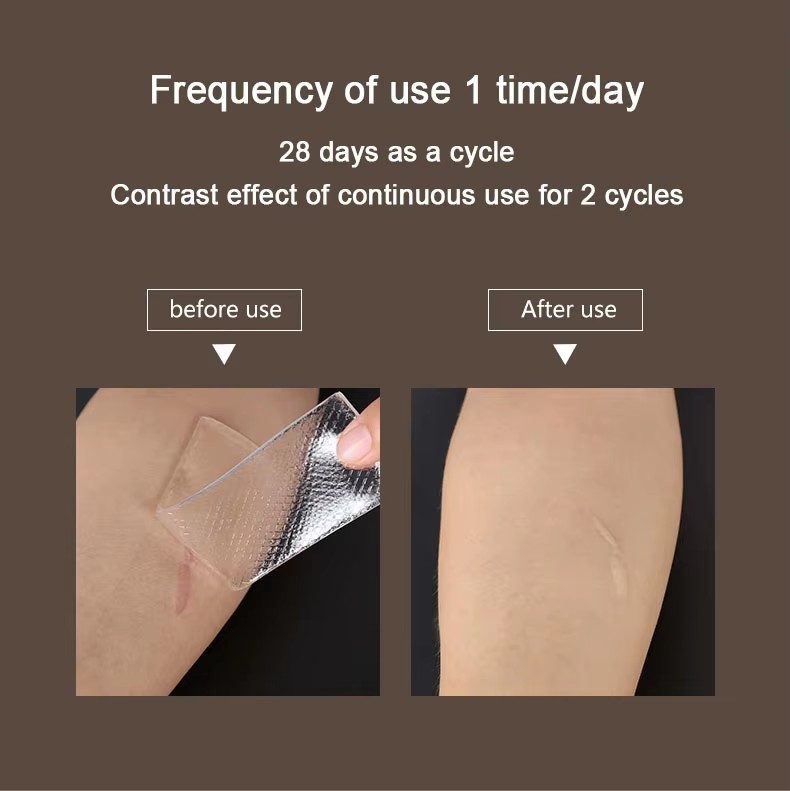 Scar Removal Silicone Gel thumbnail 8