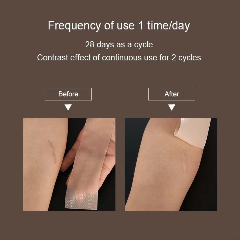Scar Removal Silicone Gel thumbnail 10