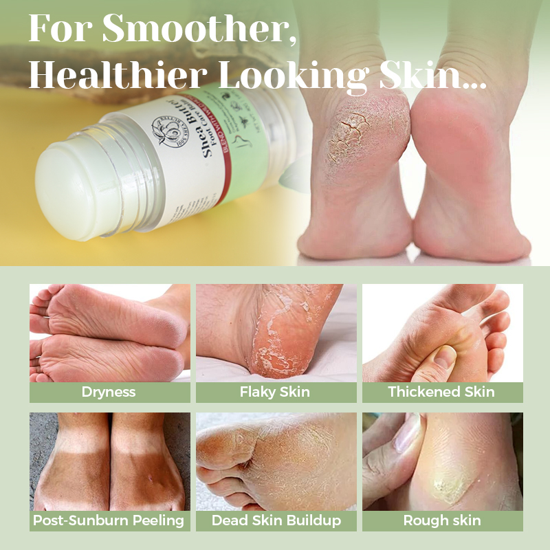 Shea Butter Heel Crack Cream - 2