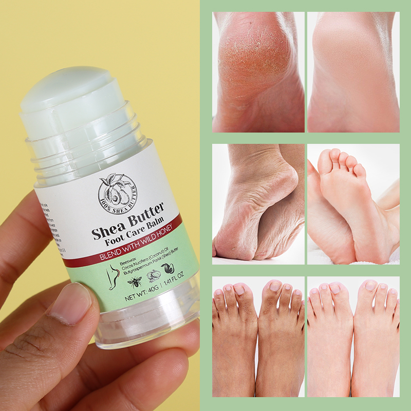 Shea Butter Heel Crack Cream - 8