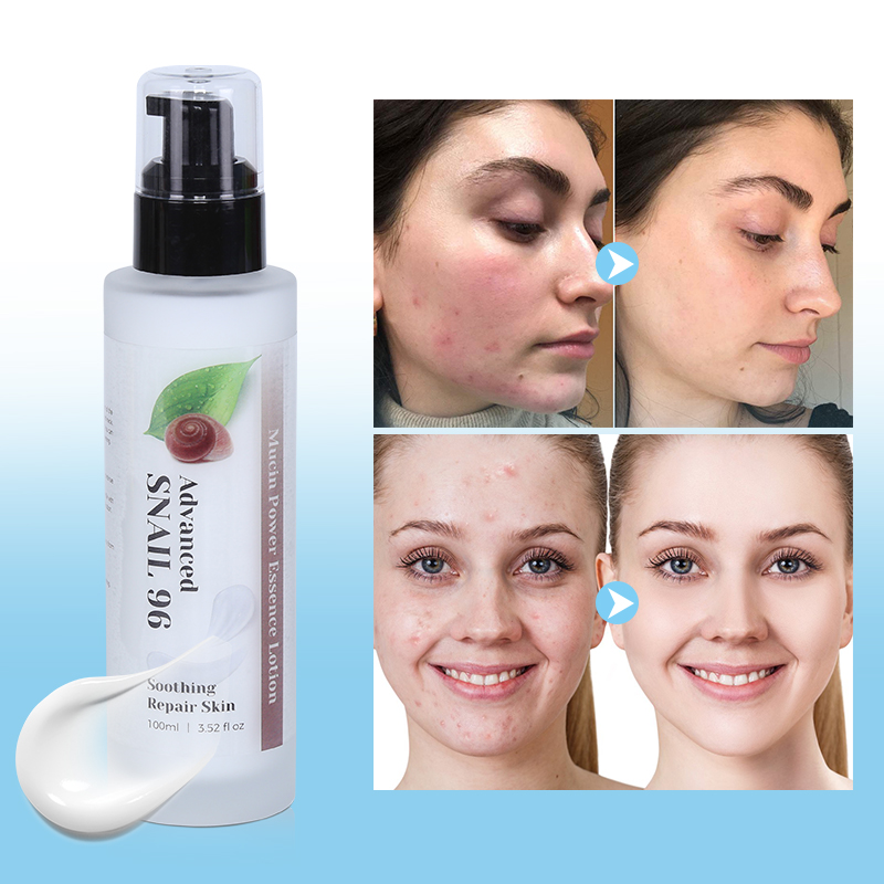 Snail Mucin Lotion - 10