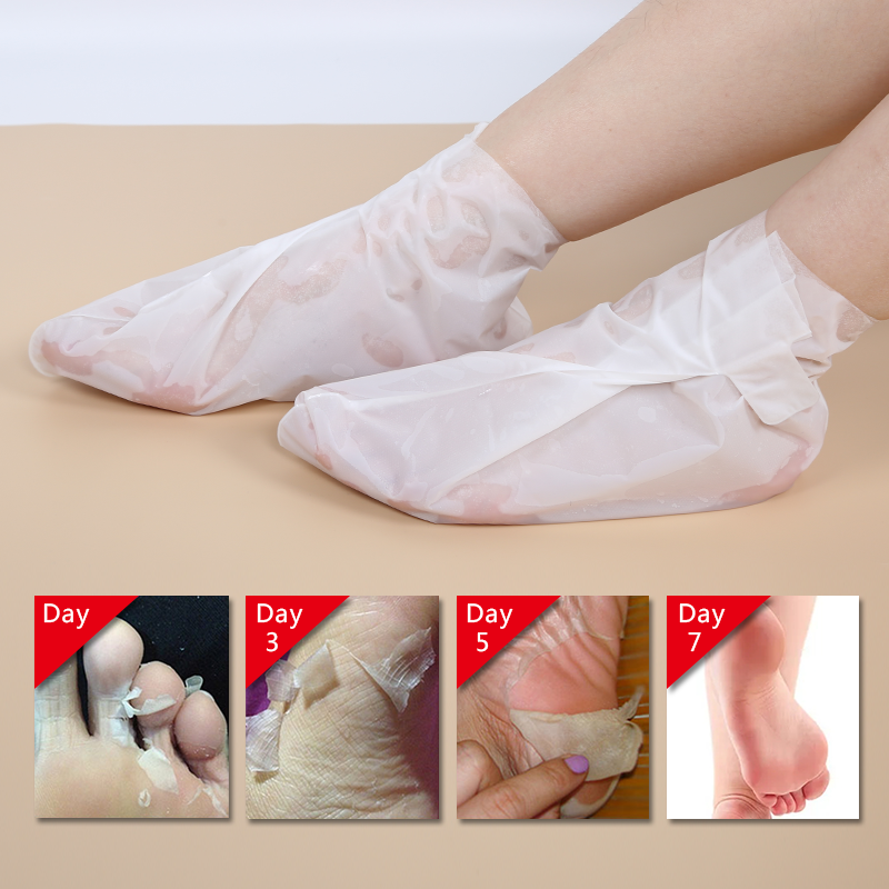 Soft Foot Mask Sleeve (Callus Removal) - 3