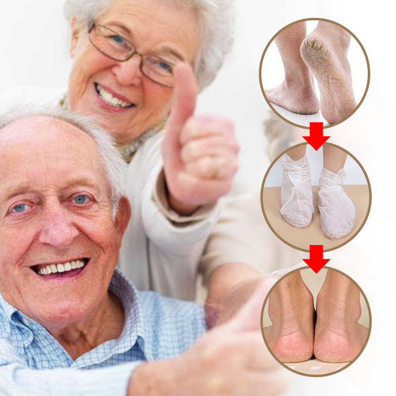 Soft Foot Mask Sleeve (Callus Removal) - 6