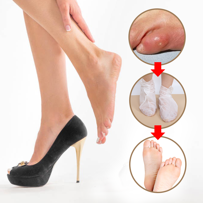 Soft Foot Mask Sleeve (Callus Removal) - 7