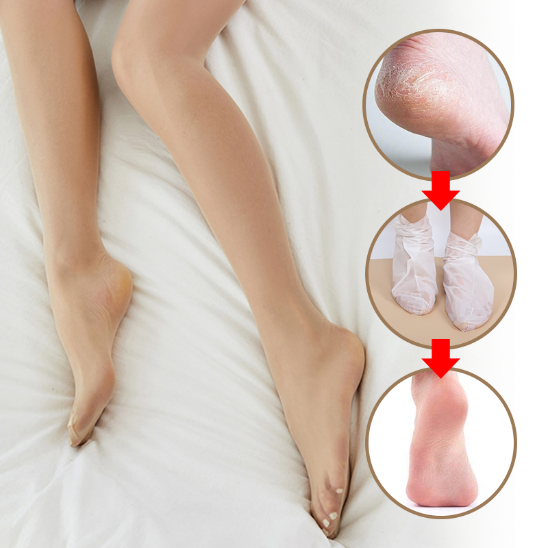 Soft Foot Mask Sleeve (Callus Removal) - 9