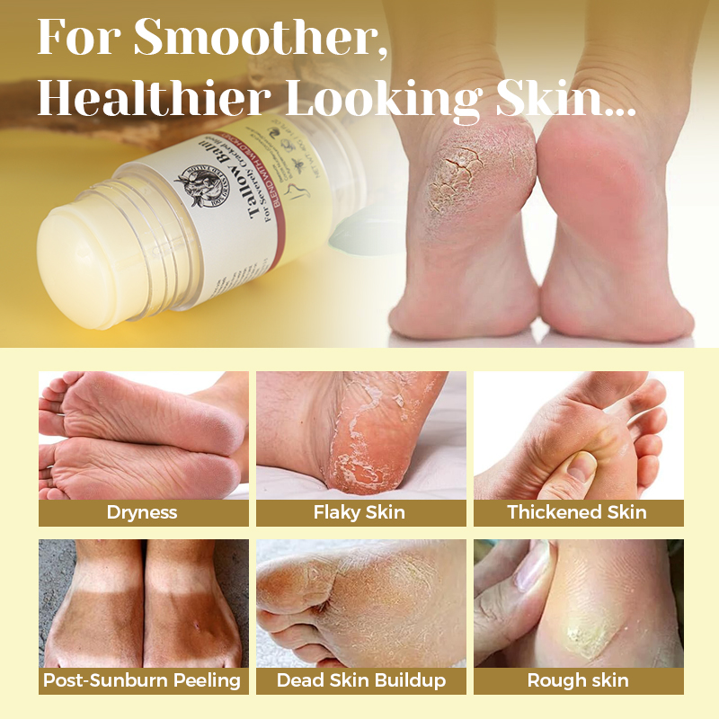 Tallow Heel Crack Cream - 3