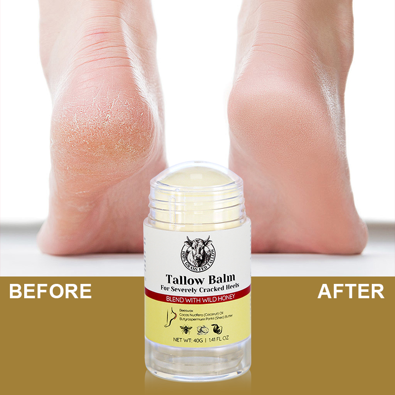 Tallow Heel Crack Cream - 14