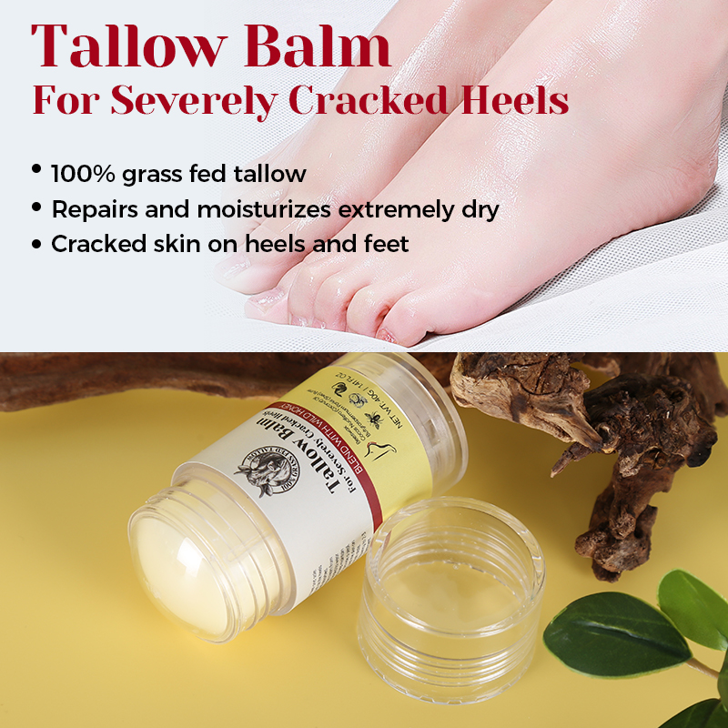 Tallow Heel Crack Cream - 15