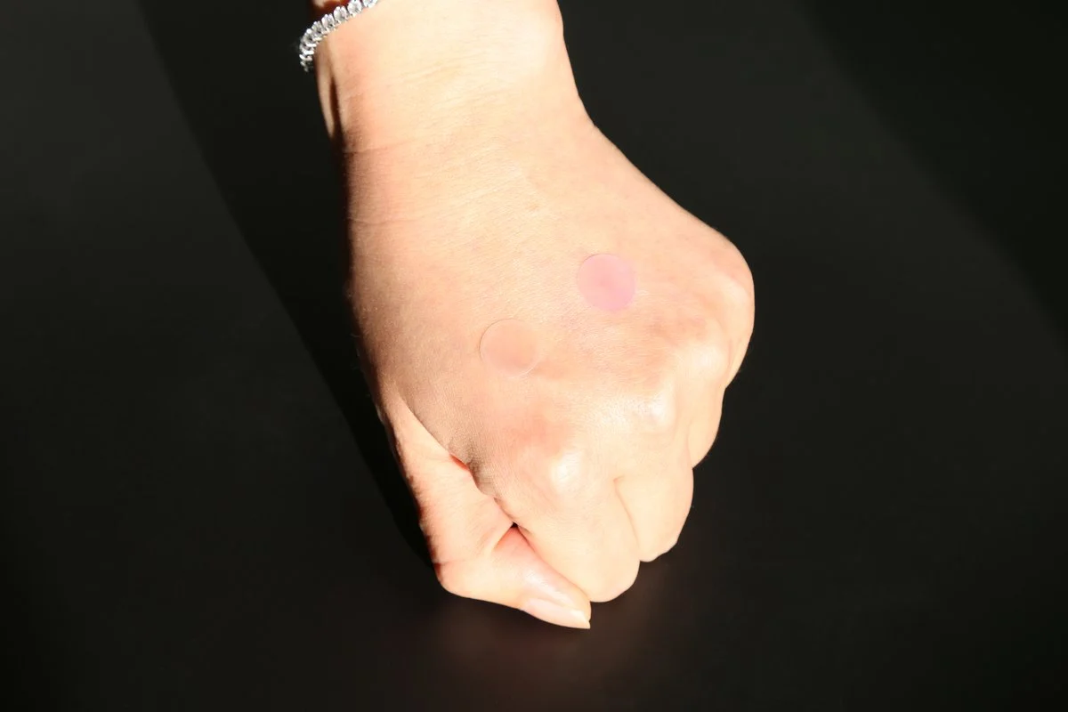 UV-Sensitive Acne Patch - 26